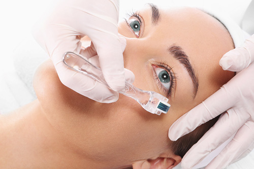 Rejuvenecimiento Facial con Factor de Crecimiento Derma - Roller y PRP